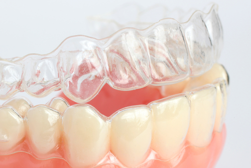 Straighten Teeth In Scarsdale With Clear Braces