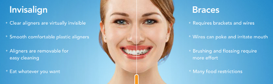 Straighten Teeth With Clear Braces in White Plains