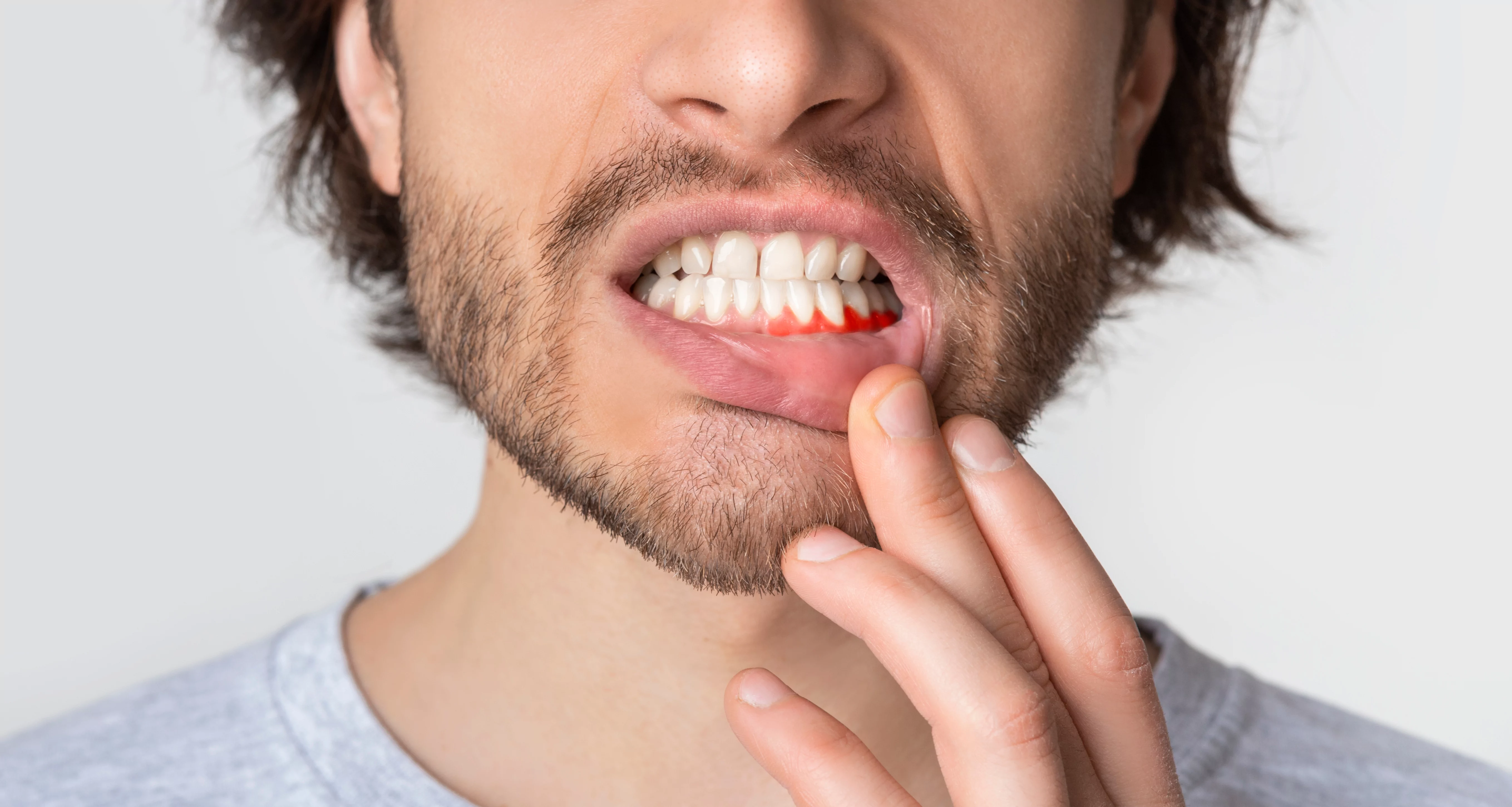 man showing healthy gums from per