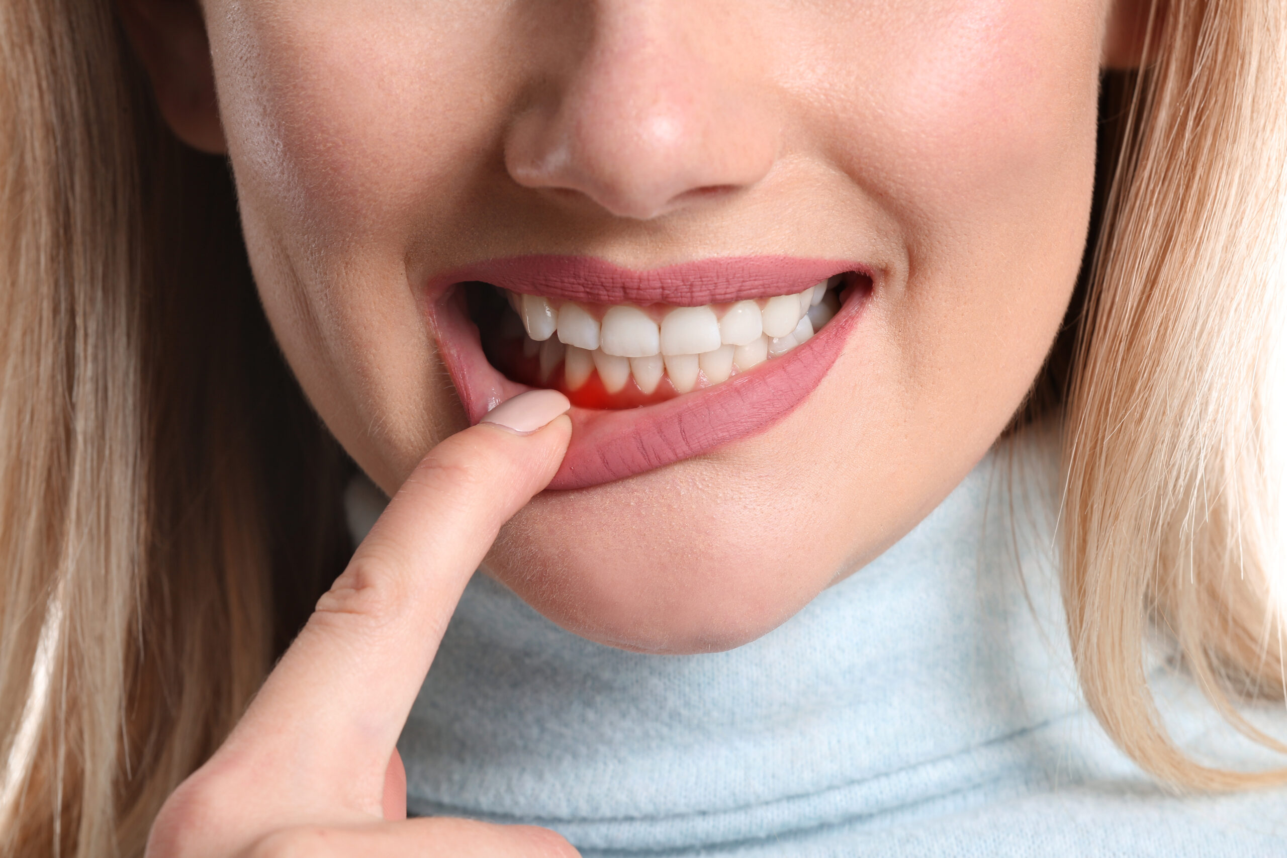 gum disease treatment in White Plains NY