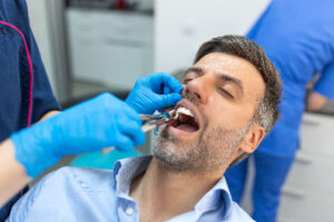 man having a tooth pulled in White Plains